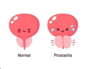 Prostinal ดีจริงไหม